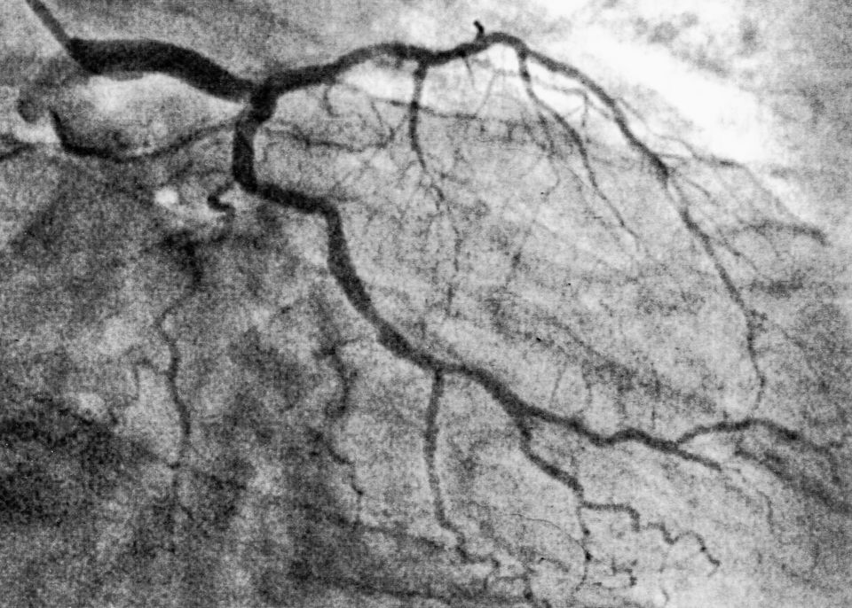 Heart Problems Resolved (3 x Cabbage), 12-17-2018